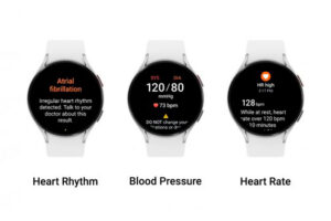 Galaxy Watch: Samsung incorpora la notificación de ritmo cardiaco irregular en 13 mercados