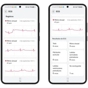 ¿Qué es la función de electrocardiograma del HUAWEI WATCH GT 5 Pro, y cómo podría salvarte la vida?