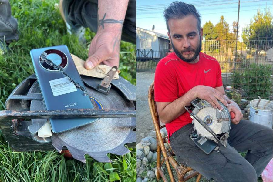 “Milagro de Navidad”: hombre salvó su pierna del corte de una sierra gracias a un HONOR Magic6 Lite