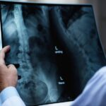 Siemens Healthineers, empresa multinacional líder en tecnología y servicios médicos: ¿Recibes más radiación en un avión o en una radiografía?